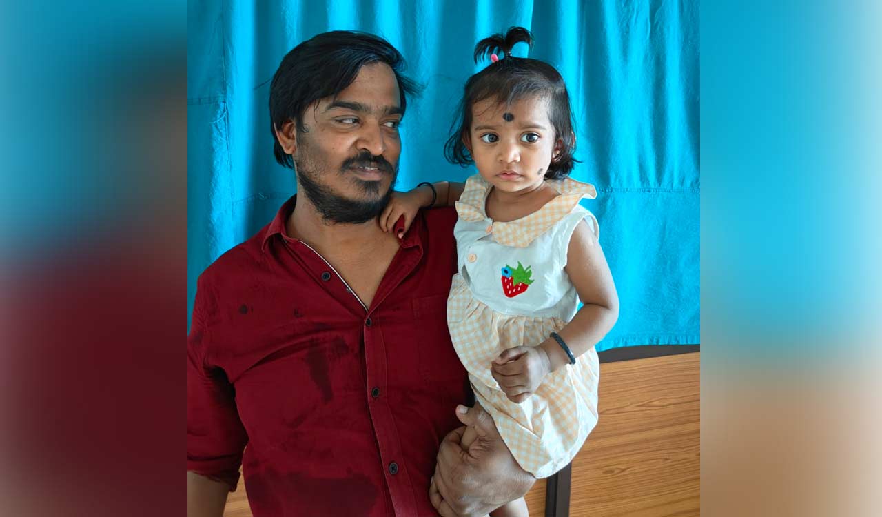 NIMS surgeons successfully treat 18-month-old with Hepatoblastoma-Telangana Today